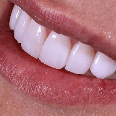 لابراتوار دندانپزشکی پورحسن